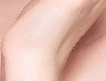 טיפולי שיניים מניעתיים בירושלים