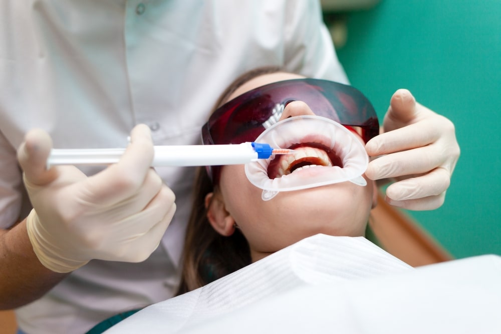 Professional Teeth Whitening Jerusalem