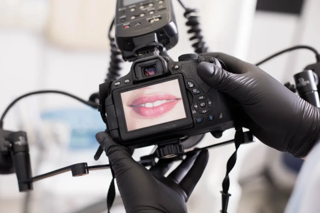 How Long Do Porcelain Dental Veneers Last?