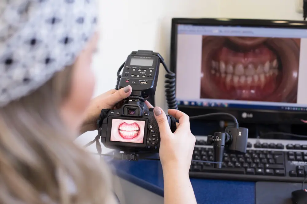 Maryland Bridge - Aesthetic Solution for Missing Tooth Replacement